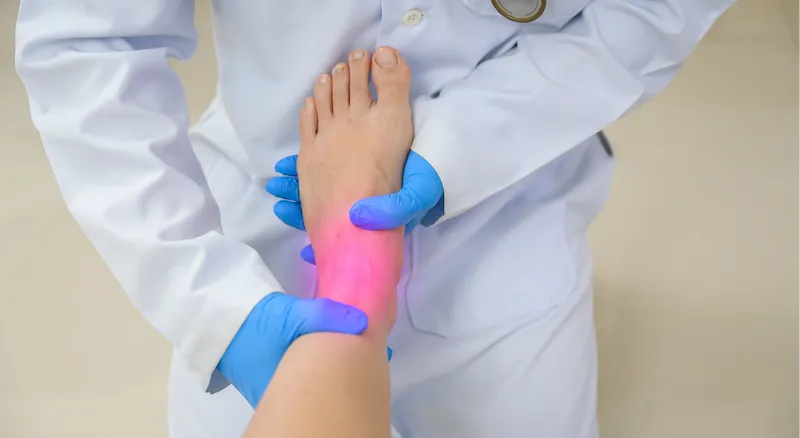 Doctor tratando musculos del pie